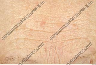 human skin wrinkled 0006